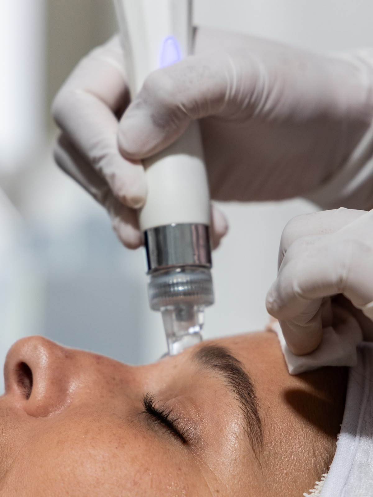 Hydrafacial